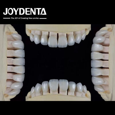 Ultra Thin Feldspathic Veneer 0.3-0.5mm Ketebalan tahan noda tinggi Pas tepat