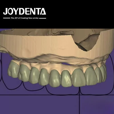 Desain Individual Digital Diagnostic Wax Up Lab Perangkat Lunak Integrasi mulus